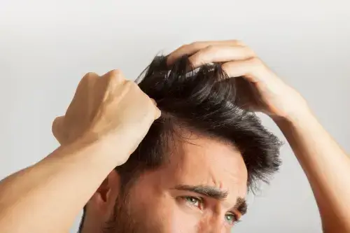 Le guide de la perte de cheveux causes